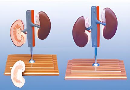 Anatomical model of pig kidney Product Code：EX-P002