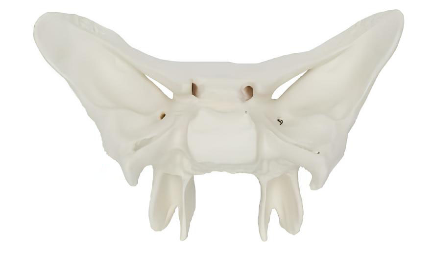 Name：Sphenoid enlargement model Model:EX-D010