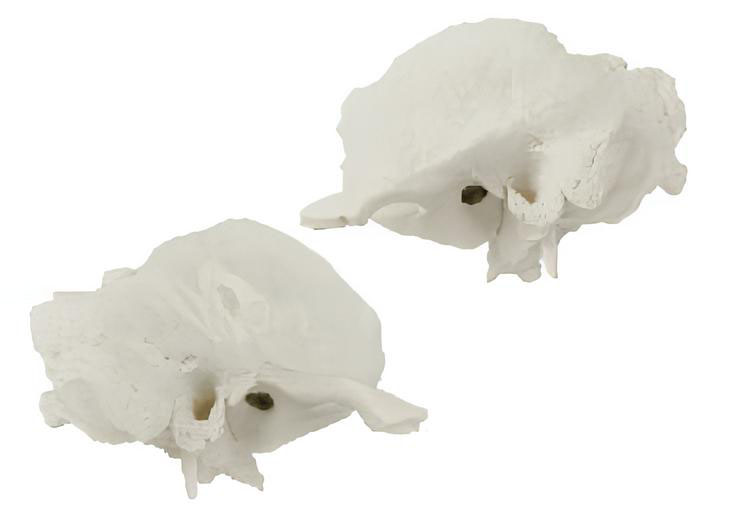 Name：Temporal bone model Model:EX-D011