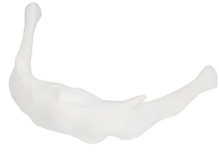 Name：Hyoid bone enlargement Model:EX-D0131